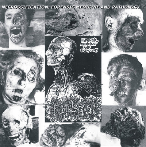 Pathologist- Forensic Medicine And Pathology CD on Bizarre Leprous Prod.