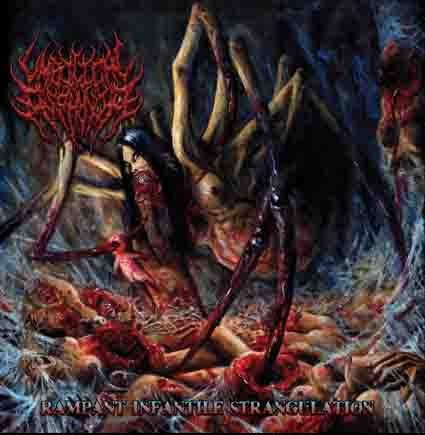 Umbilical Asphyxia- Rampant Infantile Strangulation CD on Brutal Mind