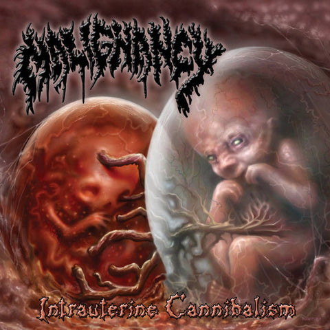 MALIGNANCY- Intrauterine Cannibalism DOUBLE CD on Sevared Rec. BACK IN STOCK!!