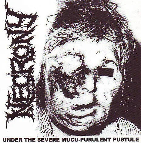 Necrony- Under The Severe Mucu Purulent Pustule CD (DISC 1 ONLY!!!)