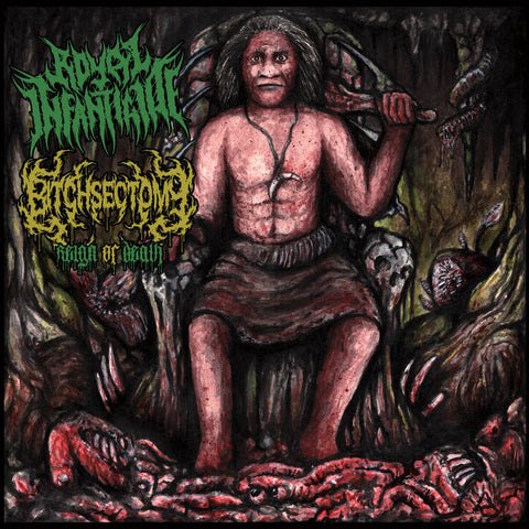 Bitchsectomy / Royal Infanticide- Split CD on Amputated Vein Rec.