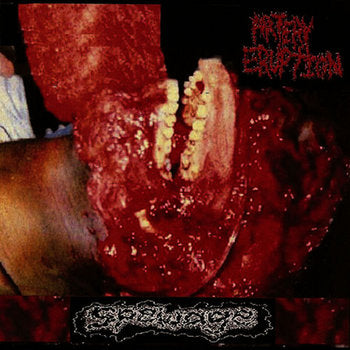 Artery Eruption- Spewage CD on Ossuary Industries