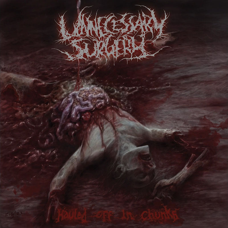 Unnecessary Surgery- Hauled Off In Chunks CD on Brutal Mind