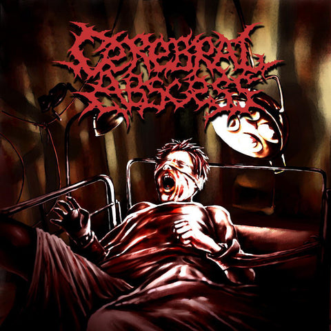 Cerebral Abscess- S/t CD on Putrescence Rec.