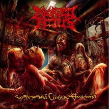 ABORTED FETUS- Goresoaked Clinical Accidents CD on Sevared Rec.