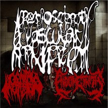 ENDOMETRITIS / GENITAL MUTILATION- Split CD on RTM Rec.