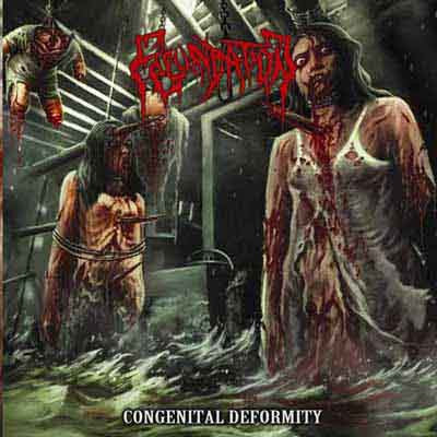 Fecundation- Congenital Deformity CD on P.E.R.