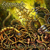 GASTRORREXIS- The Dark World Of Parasitic Infections CD