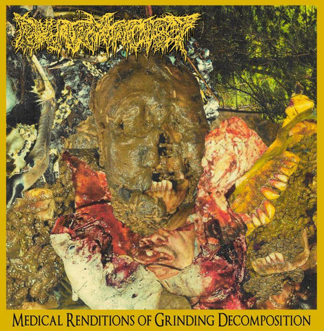 Pharmacist- Medical Renditions Of Grinding Decomposition CD on Bizarre Leprous Prod.