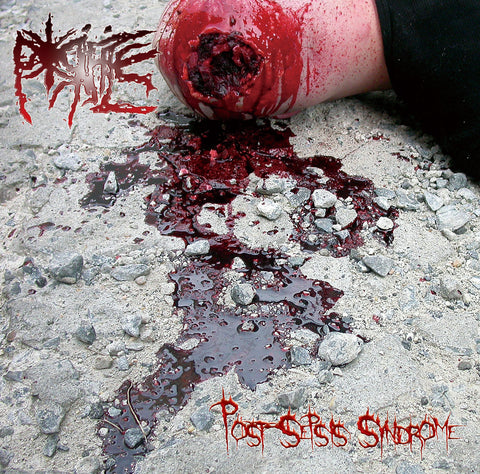 Porifice- Post Sepsis Syndrome CD on Ghastly Music