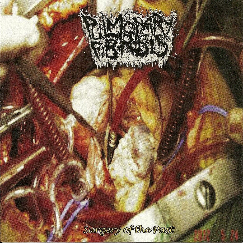 Pulmonary Fibrosis / Pilocystic Astrocytoma- Split CD on Rotten Foetus Rec.