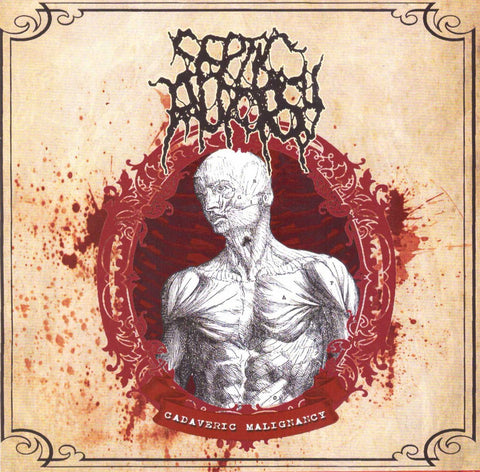 Septic Autopsy- Cadaveric Malignancy CD on Bizarre Leprous Prod.